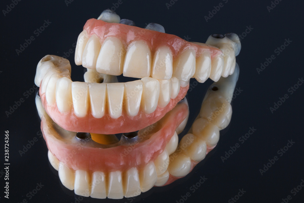 Dental composition of a prosthesis on the mirror