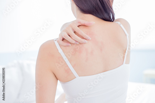 woman scratching shoulder and neck photo