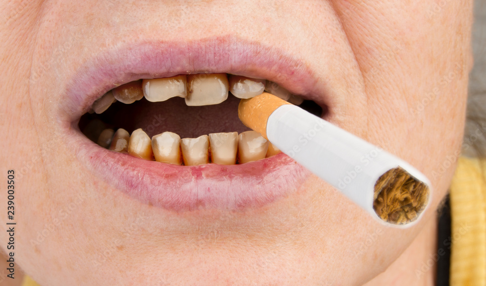 Naklejka premium a woman holds a cigarette in her mouth with bad teeth. Concept of smoking harmful effect.