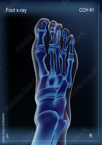 X ray of bones the of foot