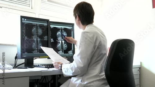 Young woman doctor examines the results of patient female breast cancer research on the computer. Mammogram showing localization of breast cancer. The surgeon can locate the exact area for excisional 