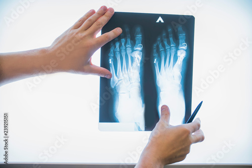 the doctor's hands show on an x-ray of the feet leg photo