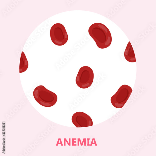 Anemia disease. Problem with hemoglobin and lack