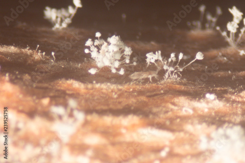 Rhizopus (bread mold) is a genus of common saprophytic fungi,Rhizopus (bread mold) under the microscope.