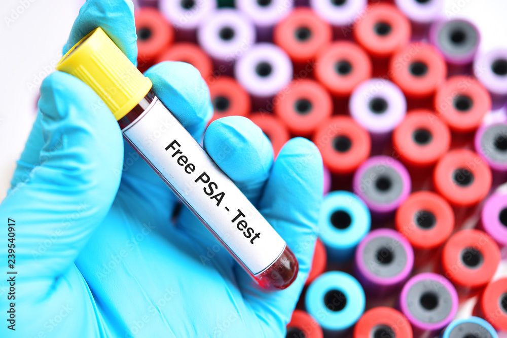 Fototapeta premium Blood sample for free PSA test, diagnosis for prostate cancer