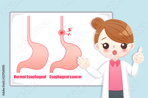 Prevention esophageal cancer
