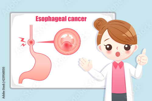Prevention esophageal cancer