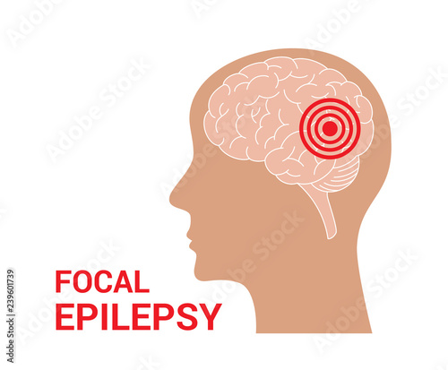 Epilepsy vector icon