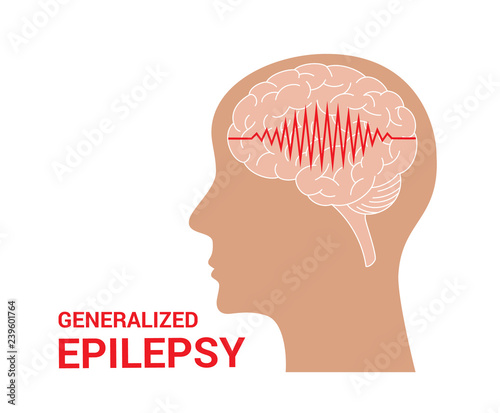 Epilepsy vector icon photo