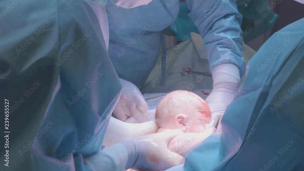 Surgical team performing surgery operation. Doctor performing surgery using sterilized equipment. Gynecologists and midwifes giving birth. Infant in maternity hospital