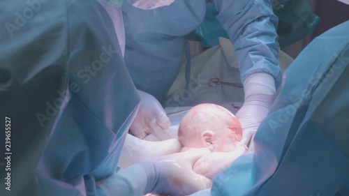 Surgical team performing surgery operation. Doctor performing surgery using sterilized equipment. Gynecologists and midwifes giving birth. Infant in maternity hospital