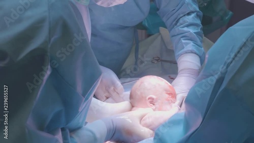 Surgical team performing surgery operation. Doctor performing surgery using sterilized equipment. Gynecologists and midwifes giving birth. Infant in maternity hospital photo