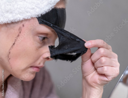 Young girl removes coal mask from face. Peel off face mask, blackhead removal. Black coal exfoliating mask for the face. Black mask deep cleansing.