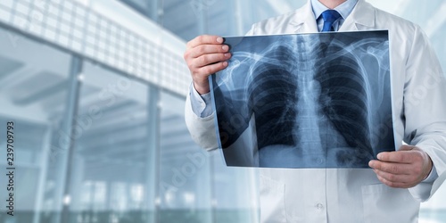 Cuadro en lienzo Xray radiology doctor hospital disease radiography ray