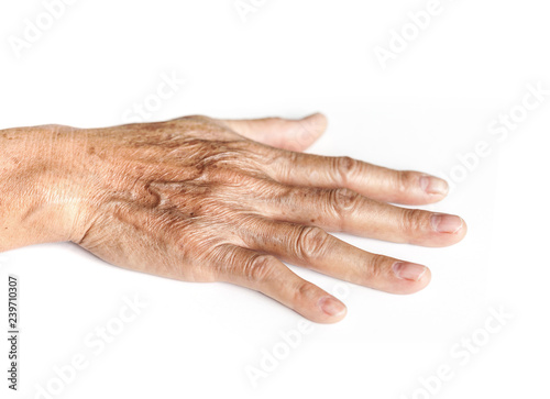 wrinkle old woman hand