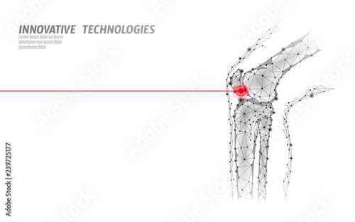 Human knee joint 3d model vector illustration. Low poly design future technology cure pain treatment. White background and red injury man body leg medicine template