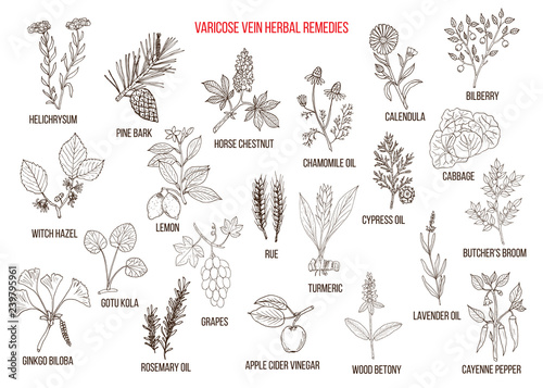 Varicose vein herbal remedies