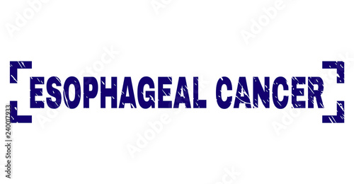 ESOPHAGEAL CANCER label seal watermark with grunge texture. Text label is placed inside corners. Blue vector rubber print of ESOPHAGEAL CANCER with dust texture.