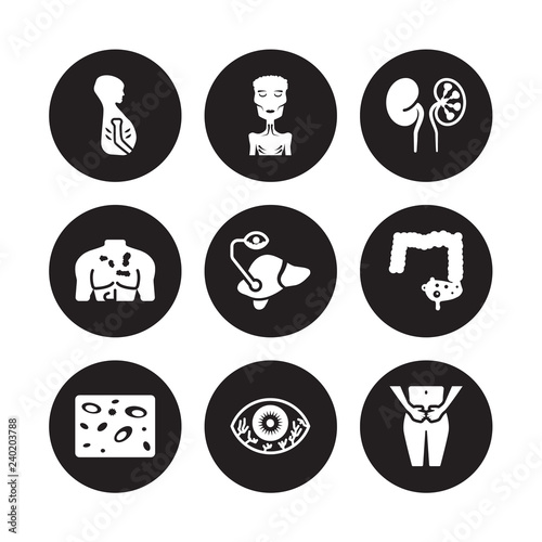 9 vector icon set : Jaundice, Irritable bowel syndrome, Infertility, Influenza, Interstitial cystitis, Iron-deficiency anemia, Iritis, Impetigo isolated on black background