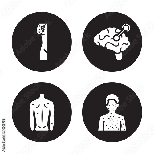 4 vector icon set : Lymphoma, Lyme disease, Lymphogranuloma venereum, Lupus erythematosus isolated on black background