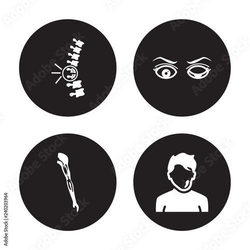 4 vector icon set : Middle East Respiratory Syndrome (MERS), Mí©niíÂre's disease, Microcephaly, Methicillin-resistant Staphylococcus aureus (MRSA) isolated on black background