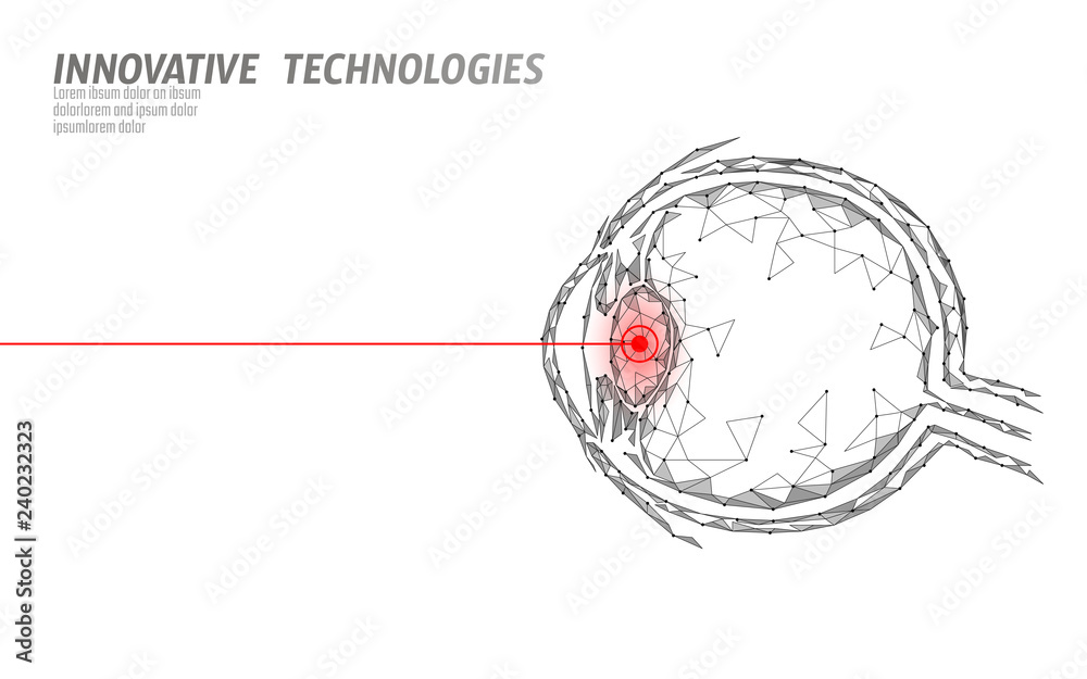 Laser vision correction medicine operation concept. Innovation