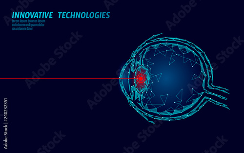 Laser vision correction medicine operation concept. Innovation technology health care. Eye 3D low poly polygonal triangle biometric scanner. Ophthalmology human eyeball banner vector illustration