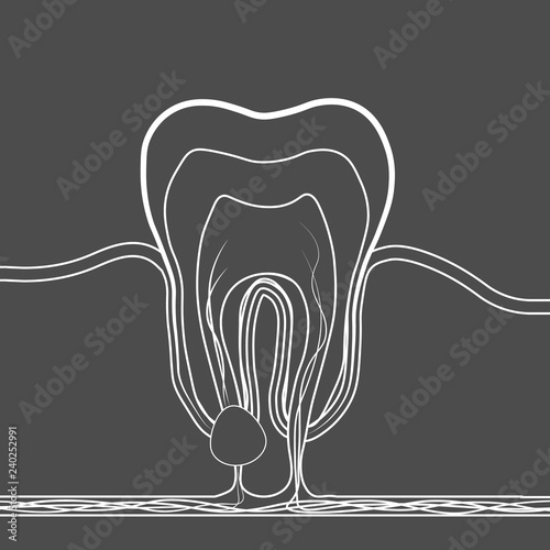 dental disease linear icon. Medical illustration of tooth root inflammation, tooth root cyst, pulpitis.