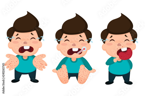 Hand foot and mouth disease (HFMD) children infected. Vector Illustration on white background. photo