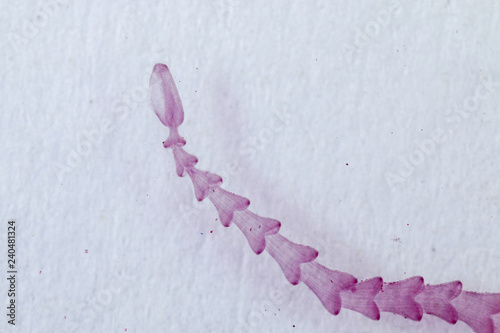 Patterns and backgrounds of Parasitic, Study of Parasitic and Anatomical pathology in laboratory. photo