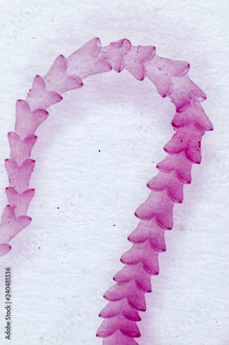 Patterns and backgrounds of Parasitic, Study of Parasitic and Anatomical pathology in laboratory. photo