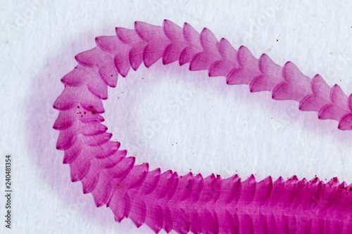 Patterns and backgrounds of Parasitic, Study of Parasitic and Anatomical pathology in laboratory. photo