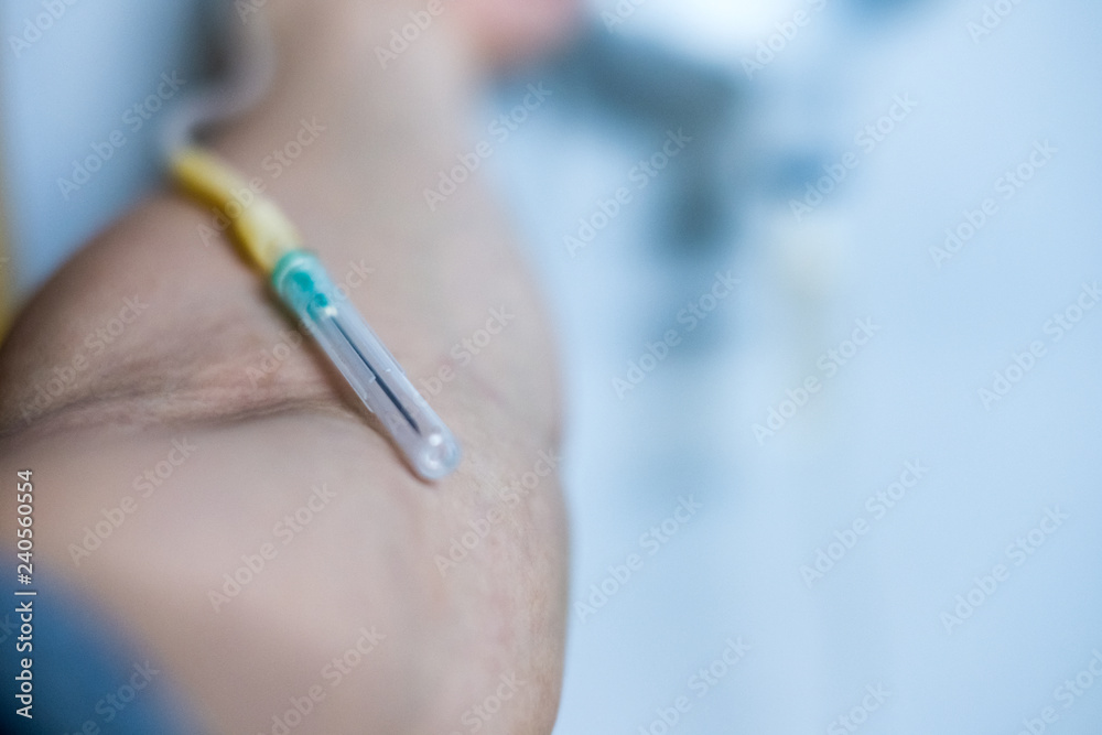 Preparing for blood donations with Hypodermic syringe on arm Preparing for blood donations with Hypodermic syringe on arm