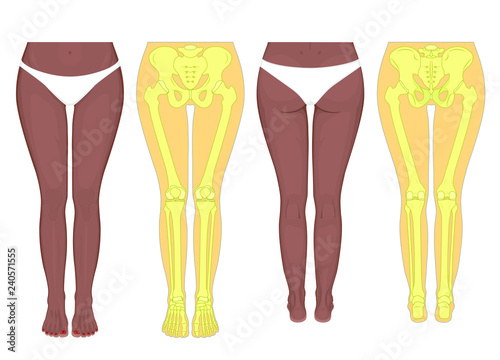 Posterior, frontal, anterior, back views of an African, Indian, Asian female legs, hips, knees, ankles with underpants. Vector illustration for advertising, medical (health care) publications