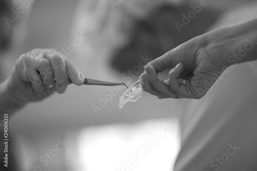 A dentist takes a disposable swab with tweezers from an assistant’s hands during patient treatment.