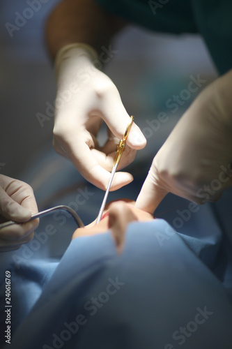 The hands of the dentist and his assistant with the tool during medical manipulations