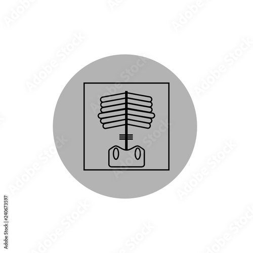 X-RAY OF THE SPINE SIGN