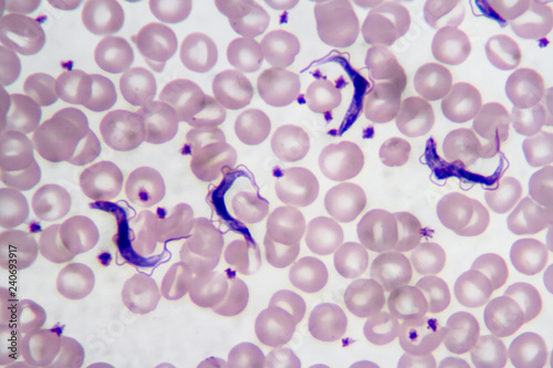 Trypanosoma gambiense blood smear