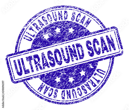 ULTRASOUND SCAN stamp seal watermark with distress texture. Designed with rounded rectangles and circles. Blue vector rubber print of ULTRASOUND SCAN title with corroded texture.