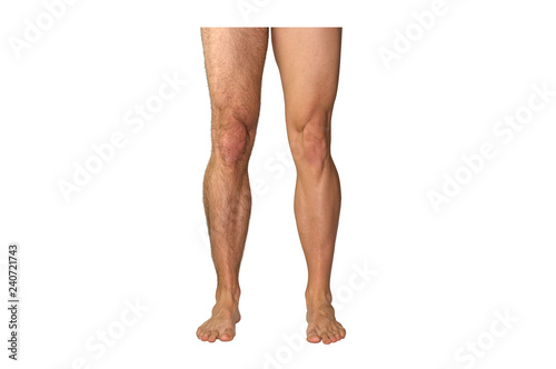 Caucasian legs of athletic man before and after shave on white background