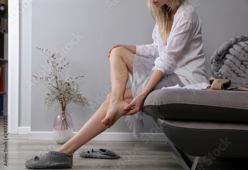 Recovery after laser varicose vein surgery. Varicose veins prevention, Compression Stockings Thigh