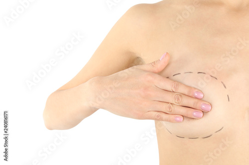 Young woman with marks on breast for cosmetic surgery operation against white background  closeup
