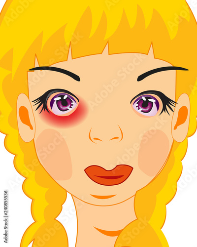 Making look younger girl with bruise under eye