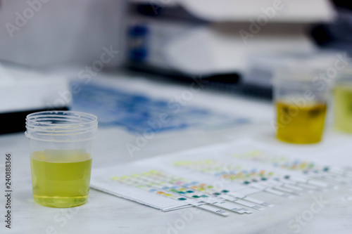 the researcher prepares tools and test strips for urine testing in a medical laboratory