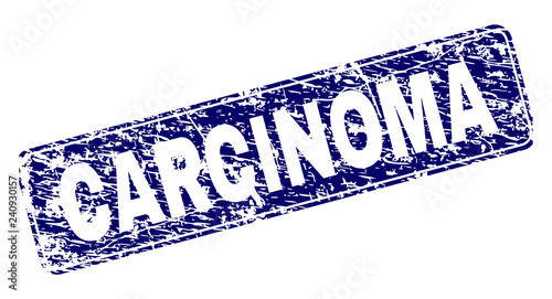 CARCINOMA stamp seal print with grunge texture. Seal shape is a rounded rectangle with frame. Blue vector rubber print of CARCINOMA text with scratched texture.