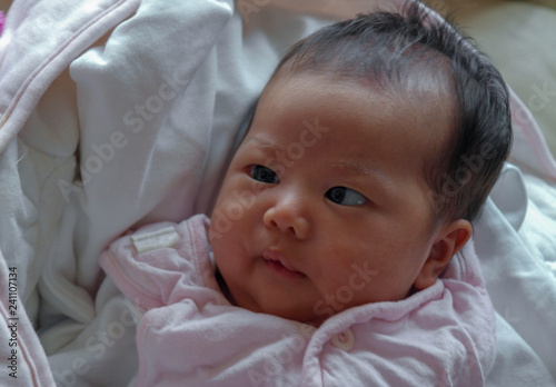 Handicap de la vue Strabisme Nouveau né petite fille métisse chinoise et  française qui louche Stock Photo | Adobe Stock