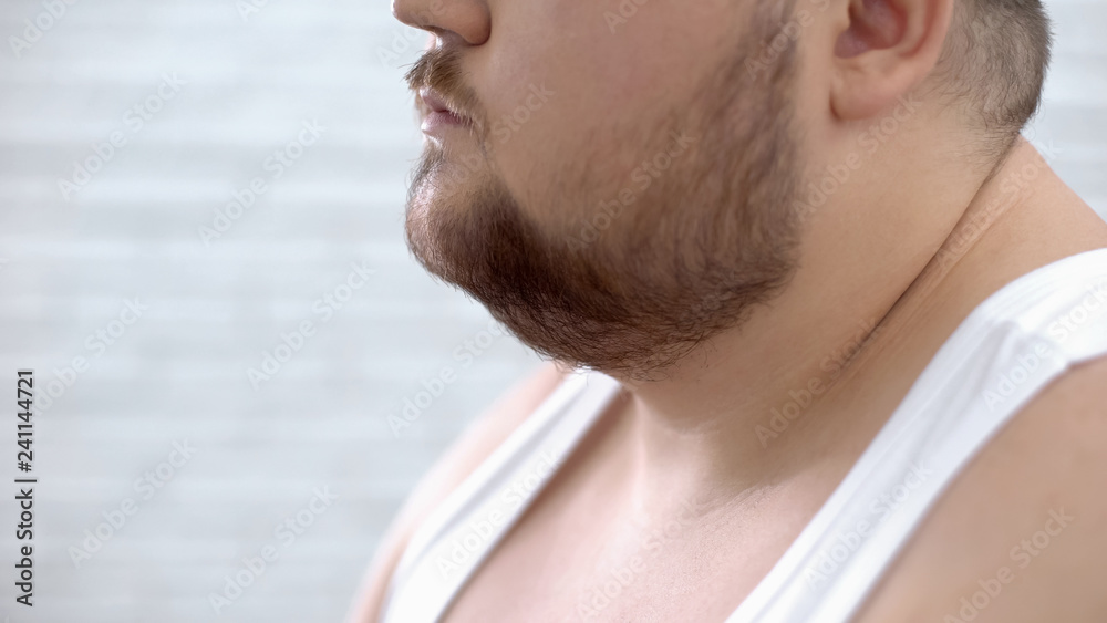 Closeup of fat bearded man in white shirt, obesity problems, lack of self-care Closeup of fat bearded man in white shirt, obesity problems, lack of self-care