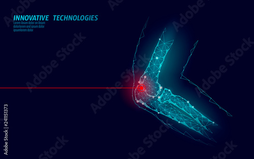 Human elbow joint 3d model vector illustration. Low poly design future technology cure pain treatment. Blue background and red injury man body arm medicine template