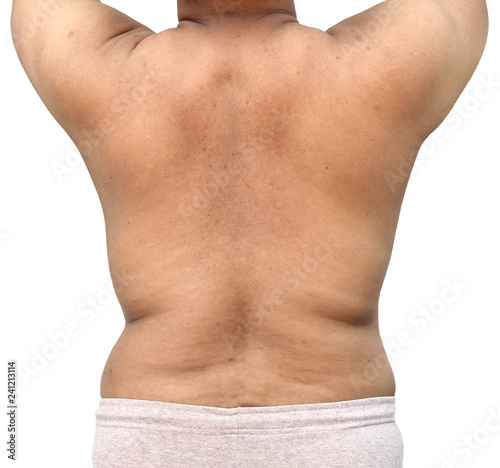 fat body of man on white background