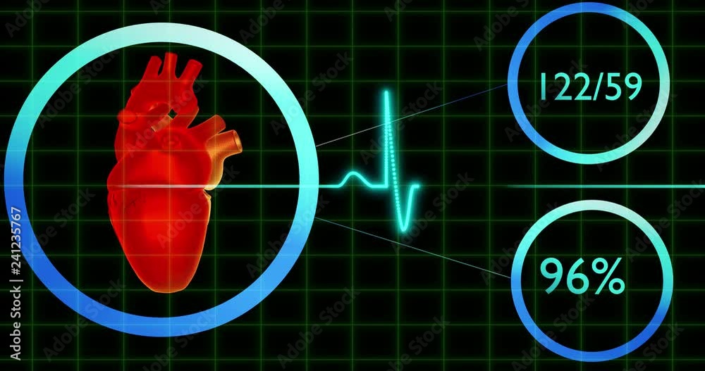 EKG Normal Heart Attack Congestive Heart Failure cardiovascular disease concept 